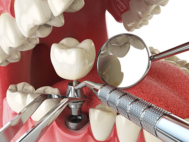 Best Emergency Dentist for Knocked-Out Tooth in Prudenville, MI