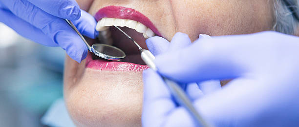 Best Emergency Dental Care for Abscessed Tooth in Prudenville, MI