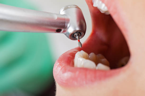 Best Emergency Dental Services for Seniors in Prudenville, MI